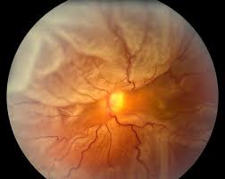 Spot The Diagnosis And Advise Treatment