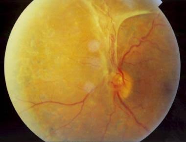 Spot The Diagnosis
