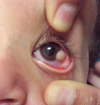 What Has Happened To This Patient?