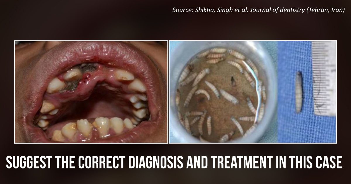 A Young Boy with Mouthful of Larvae