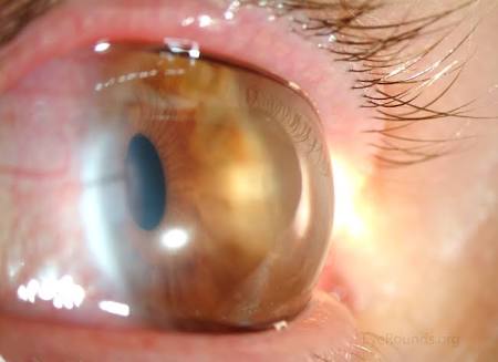 Spot Diagnosis