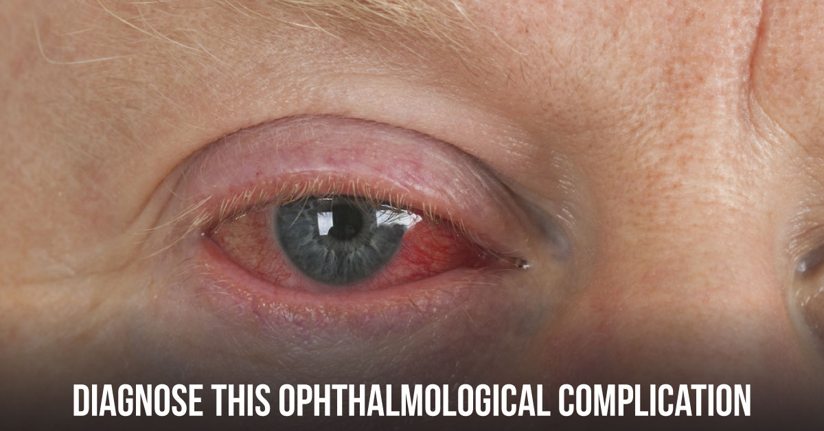Diagnose This Complex Case of a Man with Multiorgan Involvement