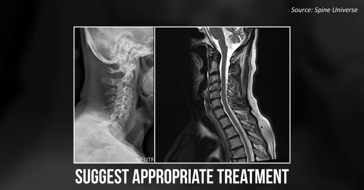 Suggest the Most Appropriate Treatment for This Patient