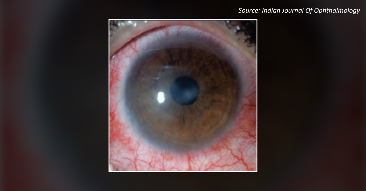 Diagnose This Case of Diminution of Vision