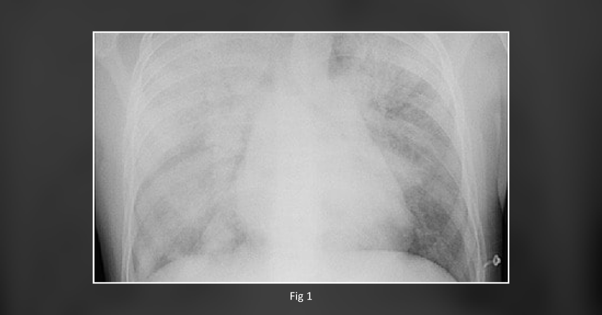 A Young Boy with a Rare Congenital Disease