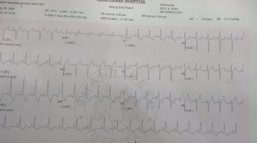 ECG  Interpretation