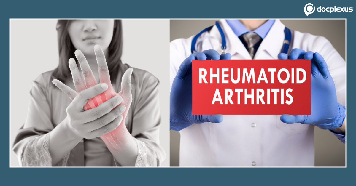 Rheumatoid Arthritis: A Brief Overview