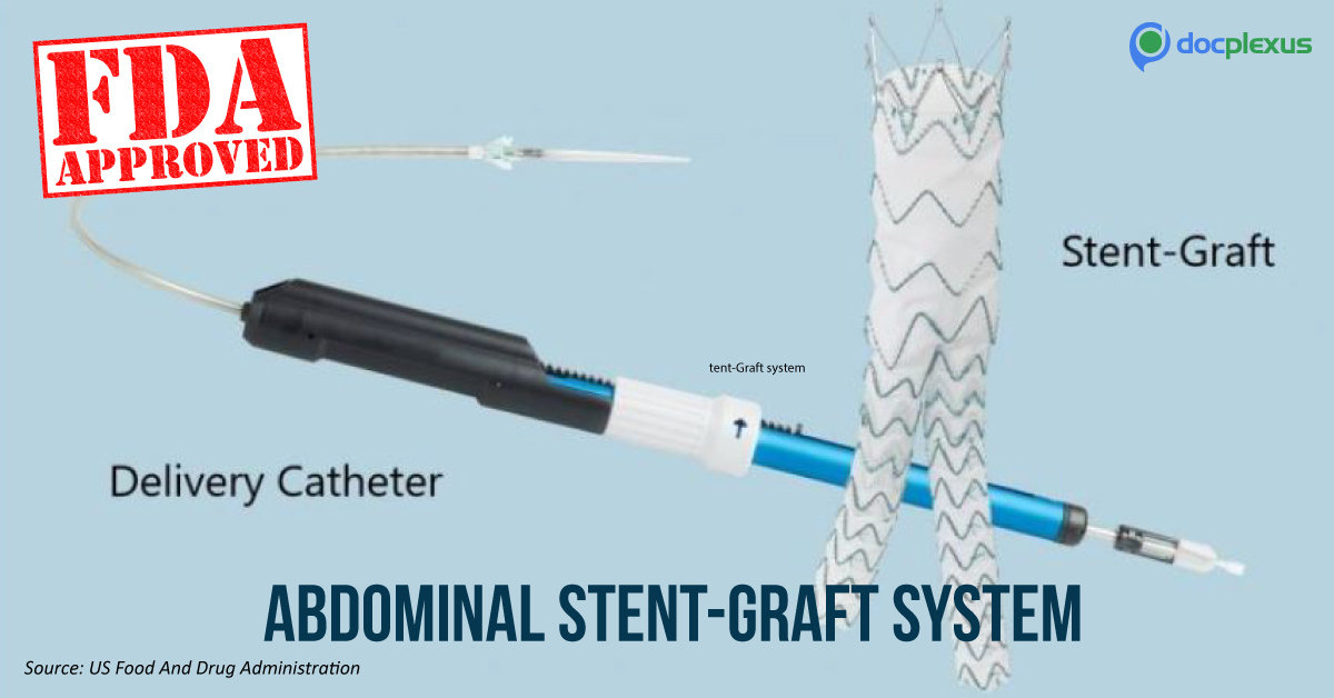 FDA Approves Abdominal Stent-Graft System For Aortic Aneurysm