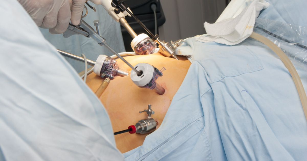 Enteric Hyperoxaluria and Dietary Oxalate