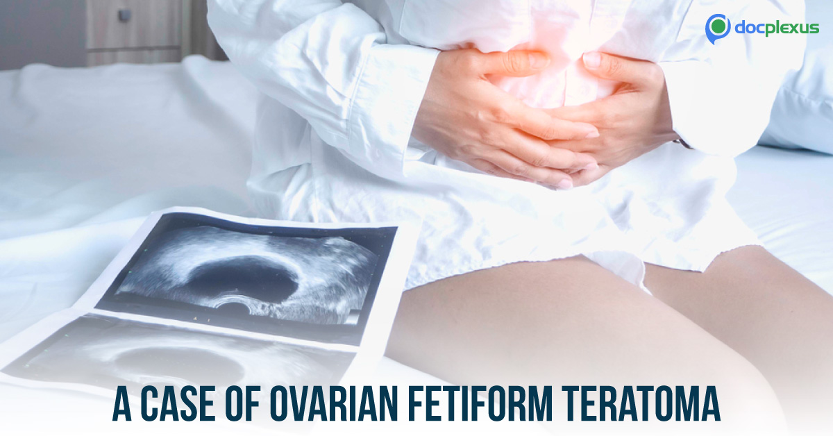 Is That an Ovarian Cyst or a Fetus?
