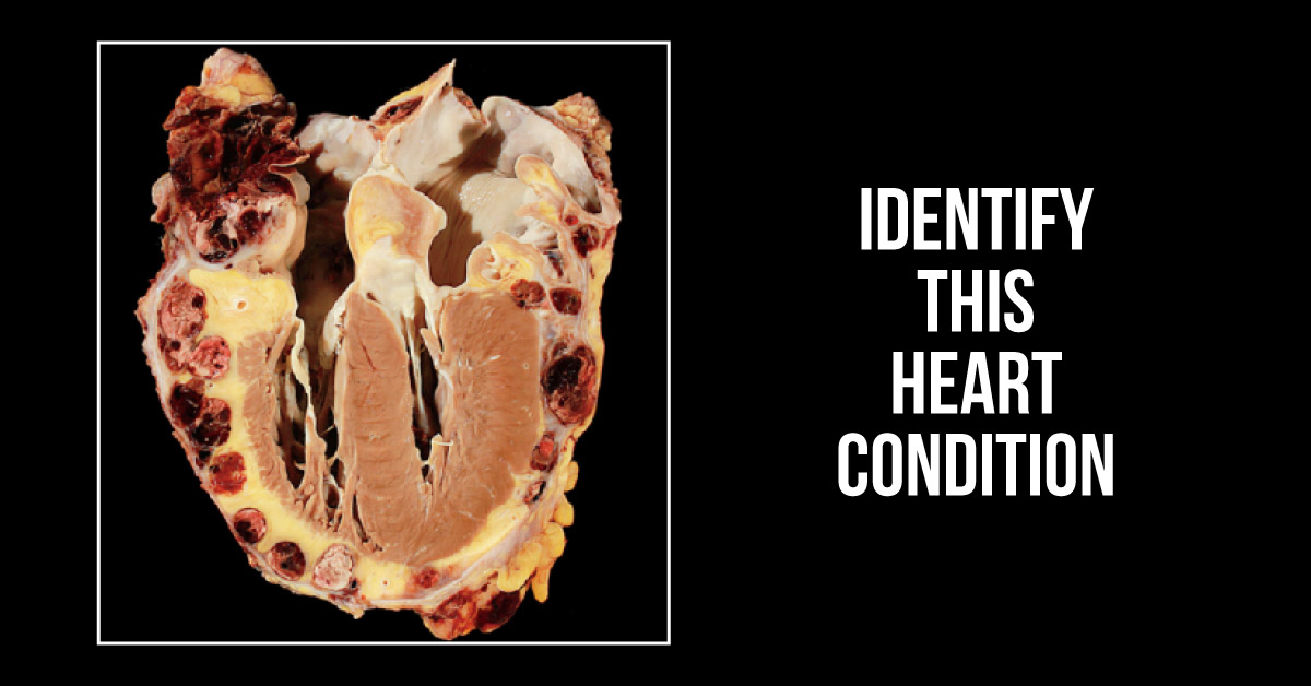 Which Condition Do These Images Suggest?