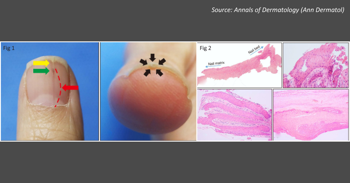 Identify The Cause Of Pain In The Thumb