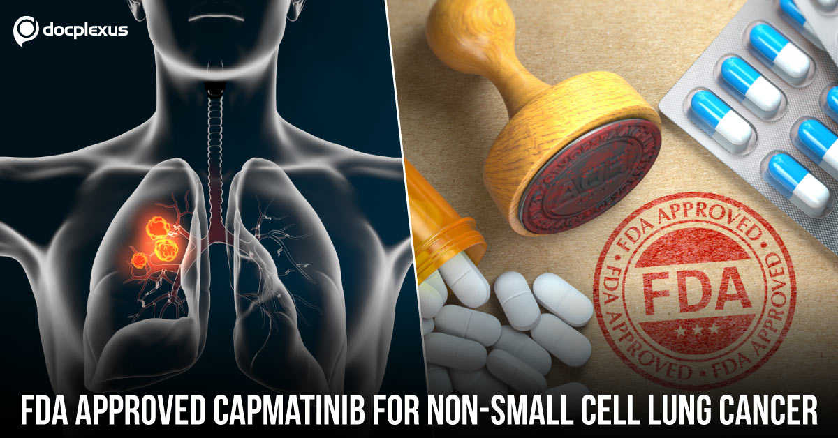 FDA Approves First Targeted Therapy For NSCLC