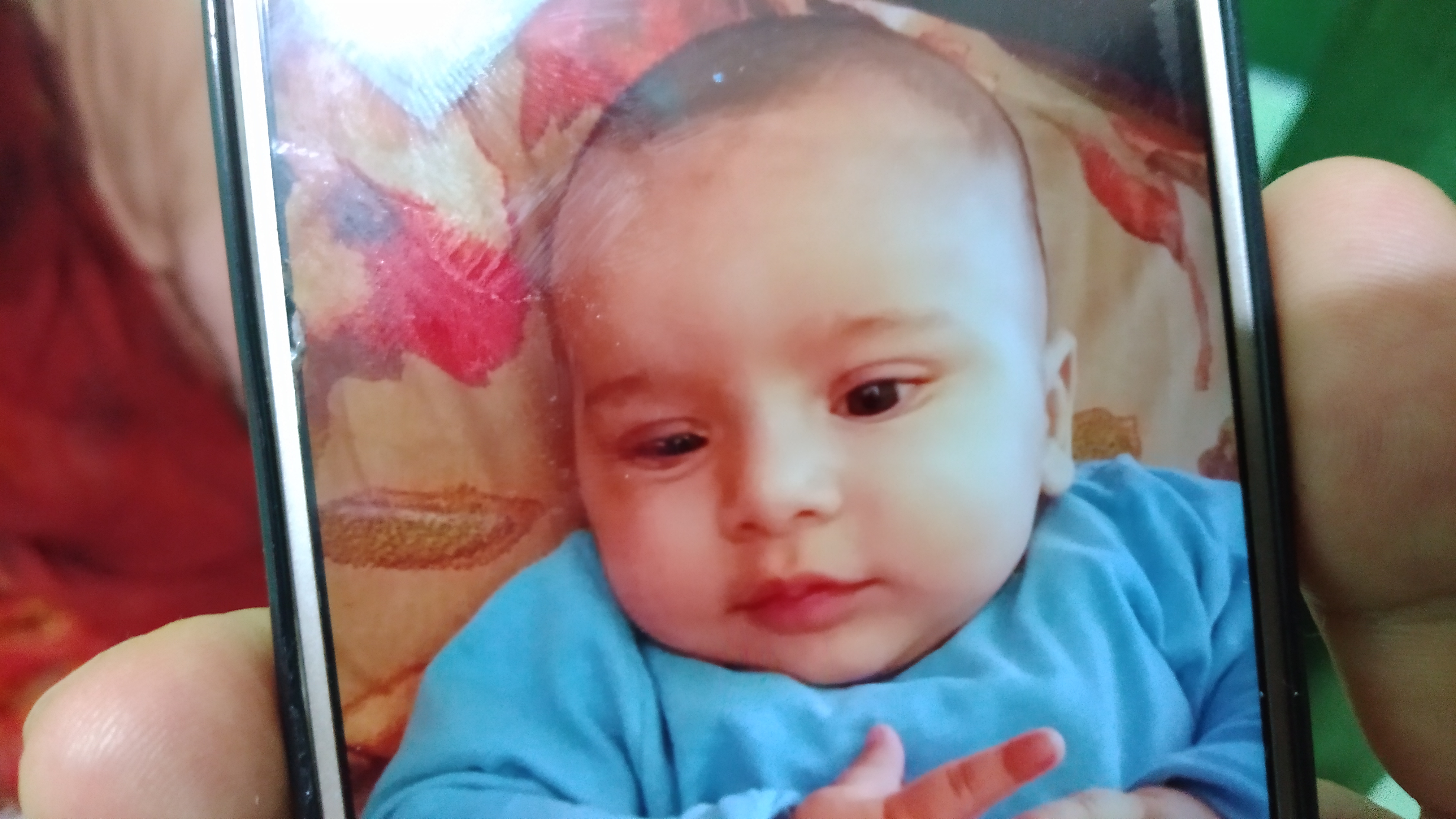 Case Of A Neonate