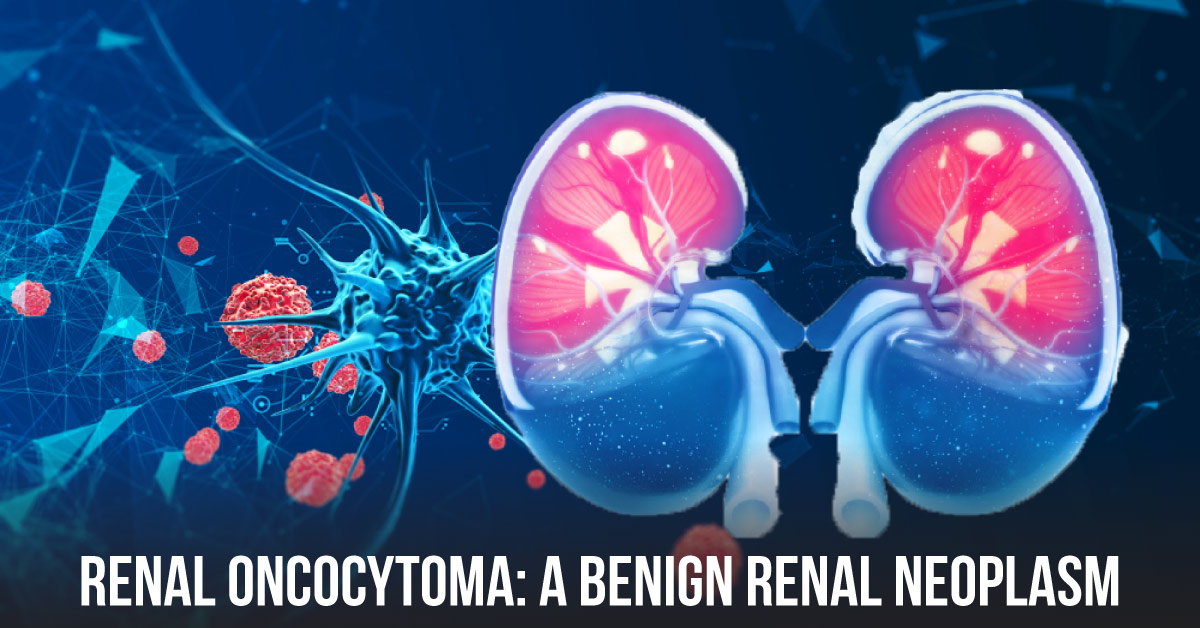 Does Renal Oncocytoma Occur Only in Adults? A Case Report