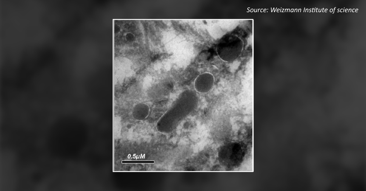 Cancer Cell And Its Mini-Microbiome – Bacteria Living Inside Cancer Cells