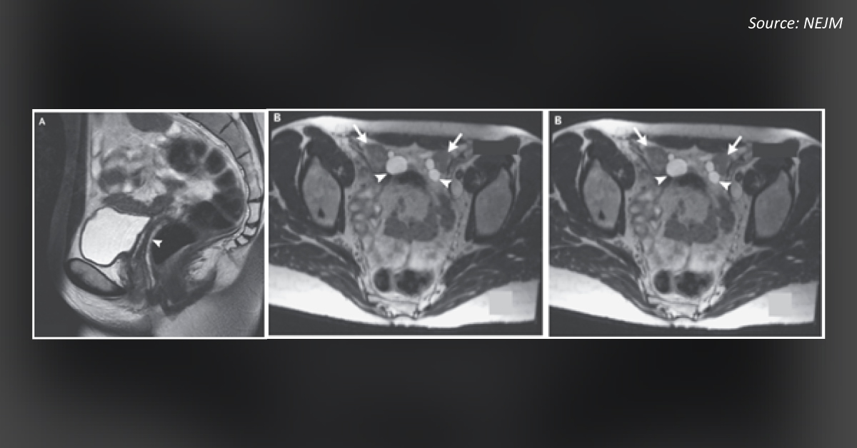 What is Your Diagnosis for This Patient?