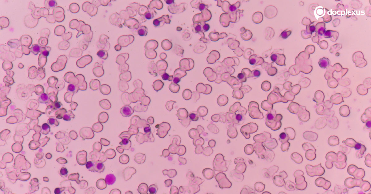 What Is Your Observation From The Blood Film