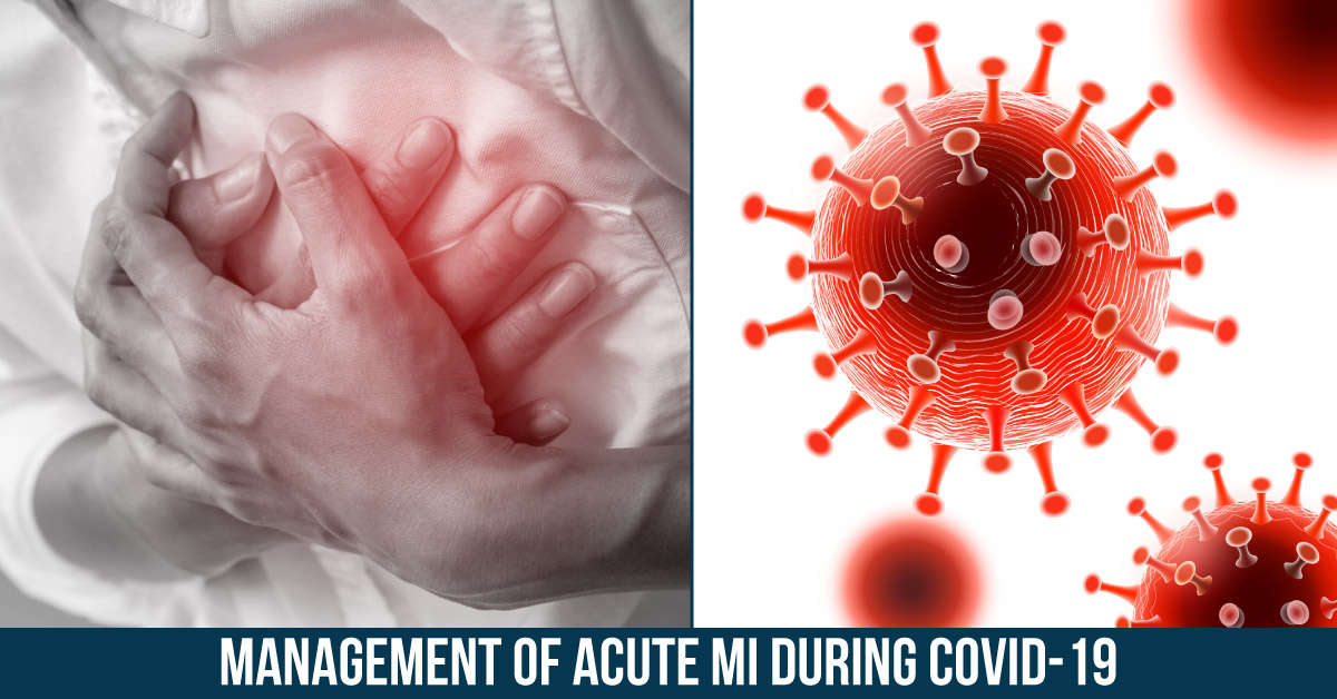 Management Of Acute MI During COVID-19