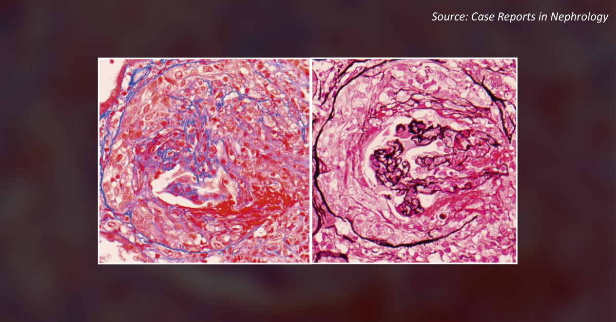 What is Your Diagnosis for This Patient?