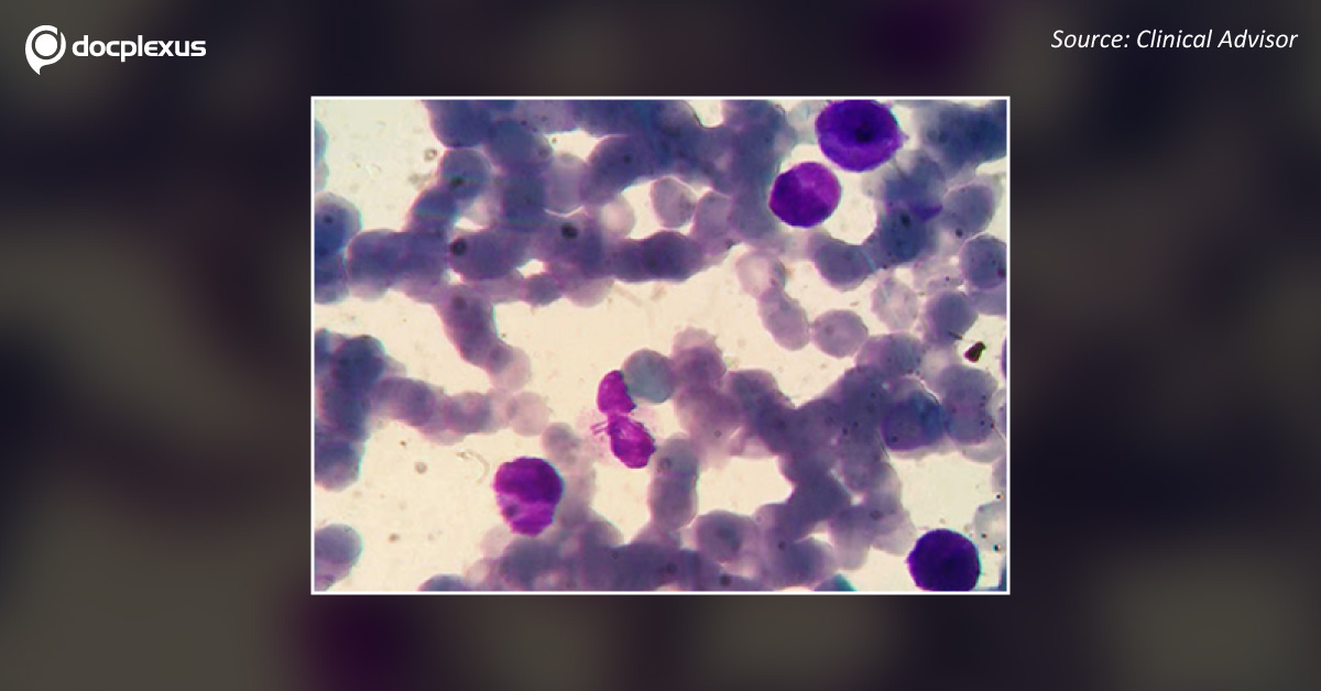 A Teenager with Abnormal Presence of Blast Cells
