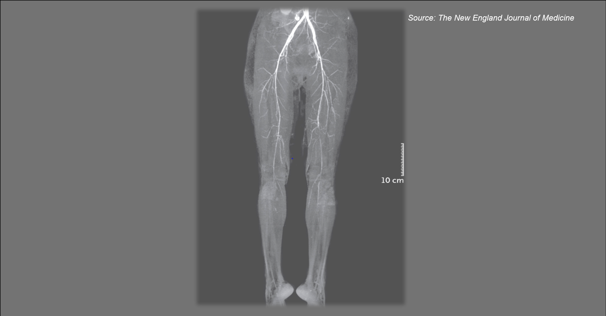 A Woman with Severe Burning Pain in Her Leg