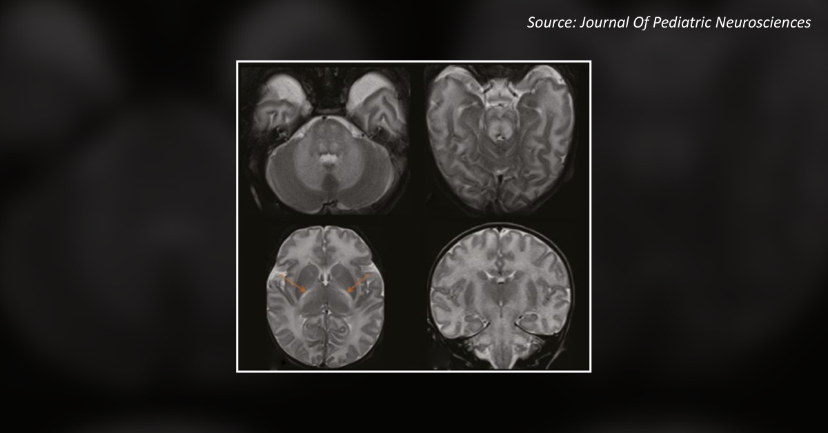 Identify the Reason Behind Metabolic Acidosis and Ketosis in This Infant