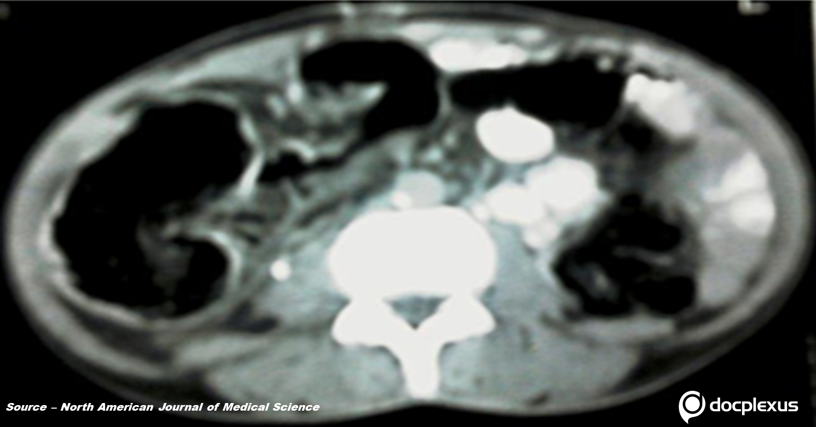 A Case of Abdominal Discomfort