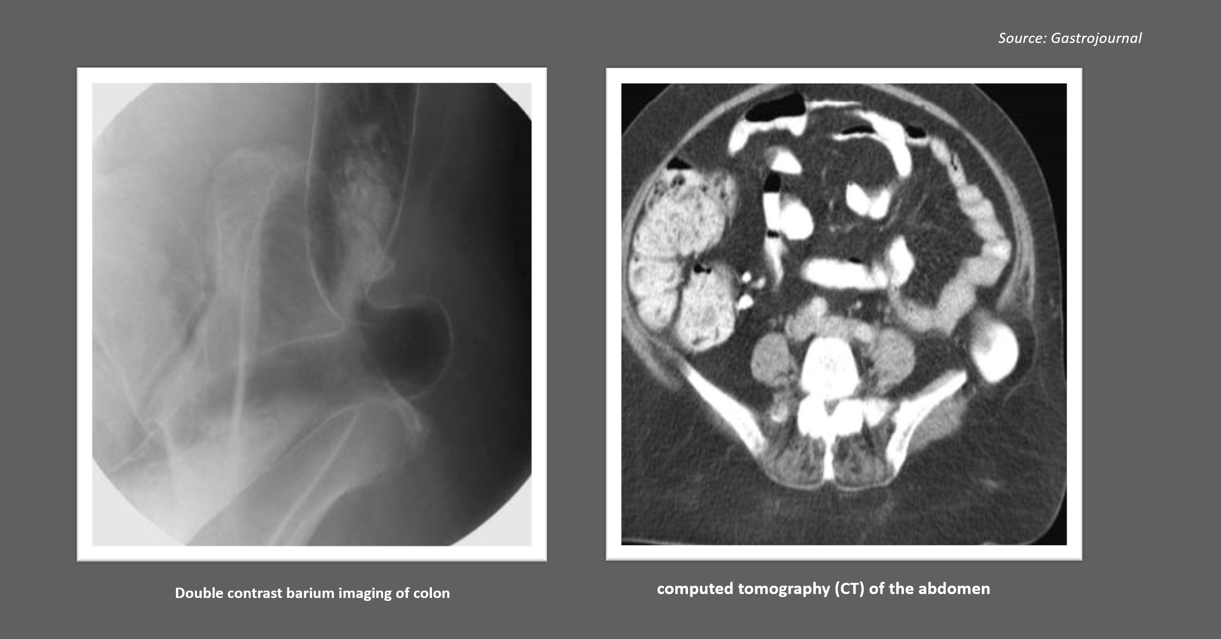 Diagnose the Patient Based on Radiology Findings