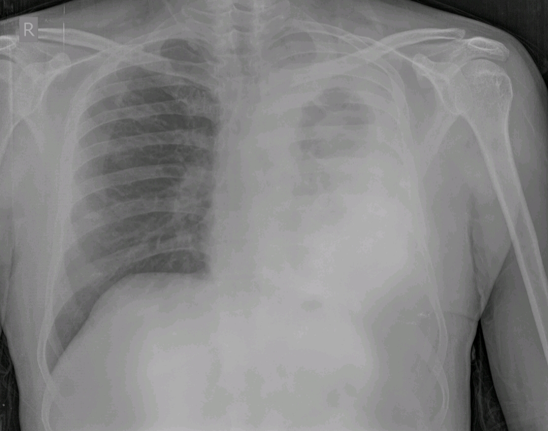What Is The Differential Diagnosis 