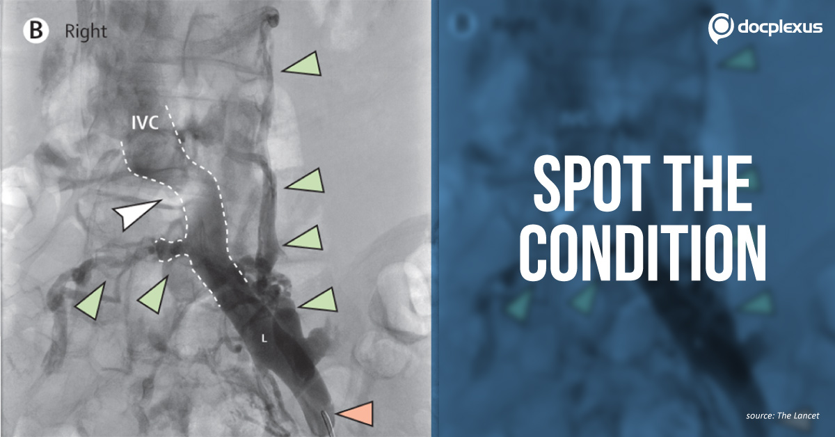 Decode The Cause Of Pain And Swelling In the Patient