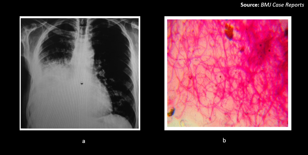 What is Your Diagnosis in This Case?