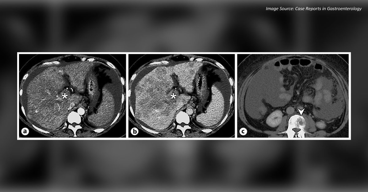 Identify the Condition in This Female with Abdominal Pain
