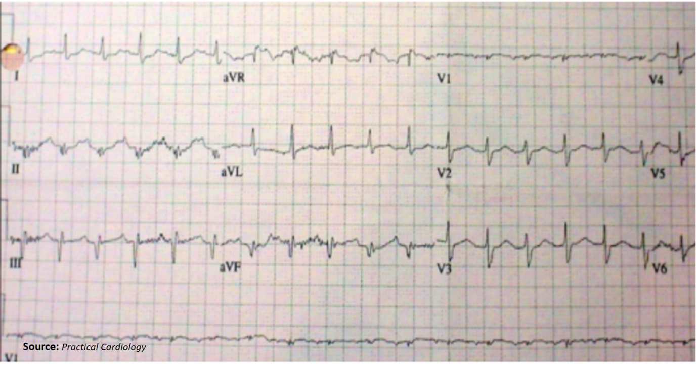 A Female Patient with a Feeling of Having an Asthma Attack