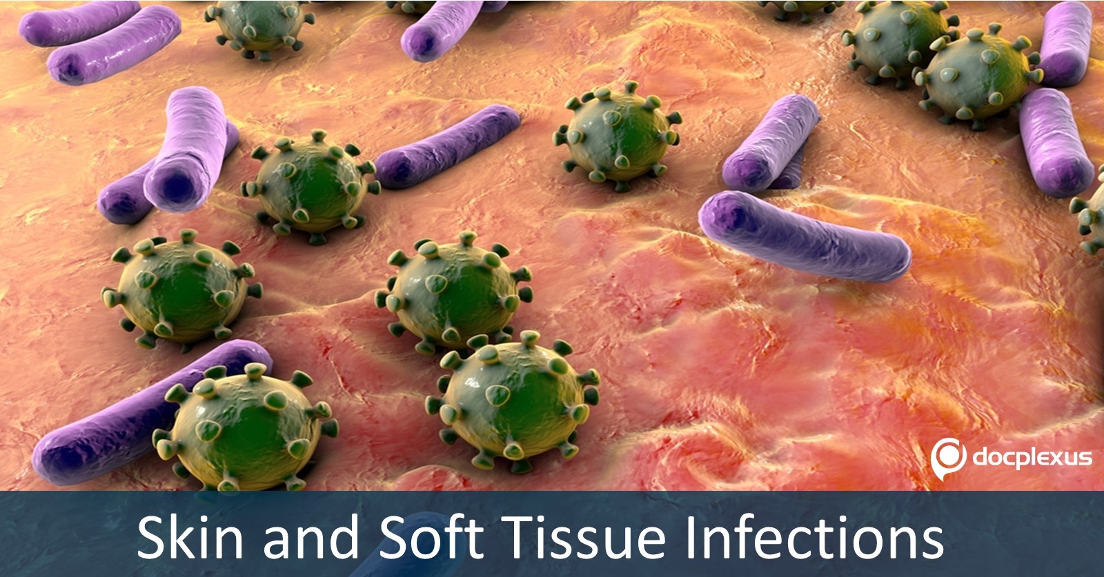 Skin And Soft Tissue Infections: An Overview