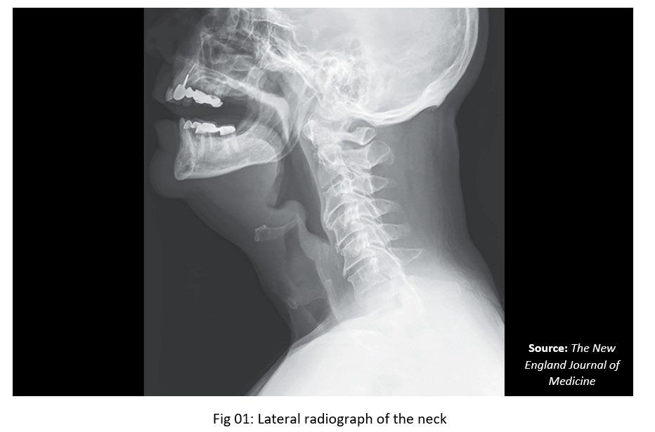 Can You Diagnose The Condition Based On This Image?