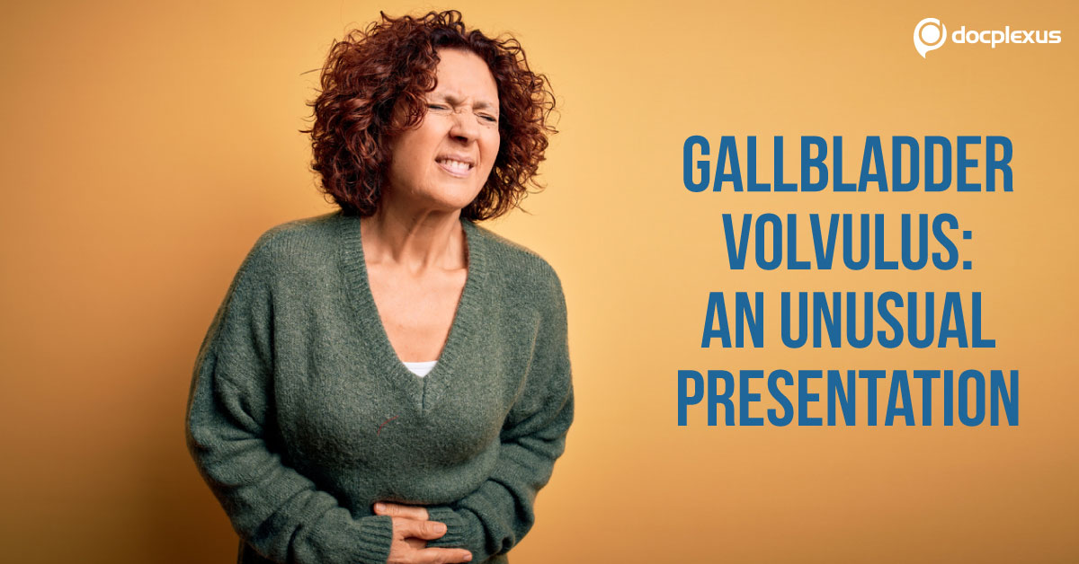 A Rare Occurrence of Gallbladder Torsion