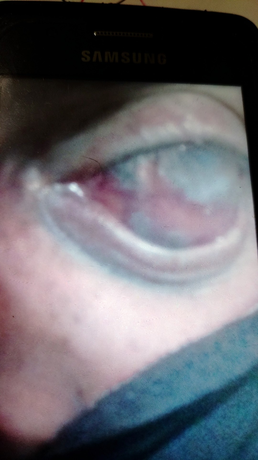 Picture Of Dense Kerstapathy