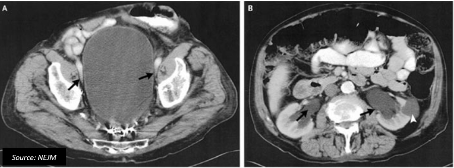 Diagnose This Interesting Case Of Urology