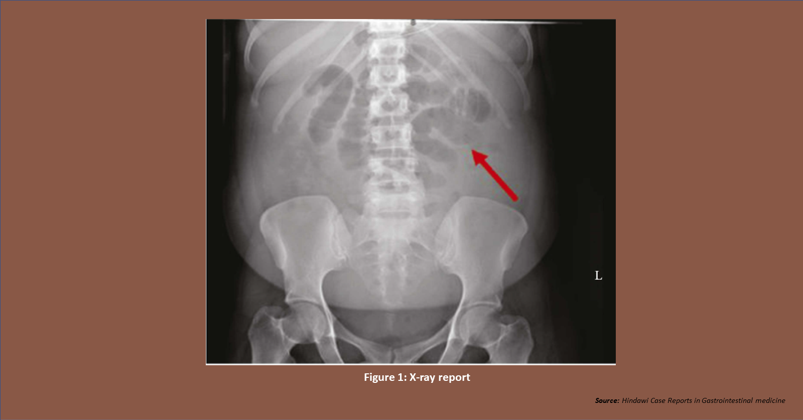 Can You Diagnose the Medical Condition of this Patient?