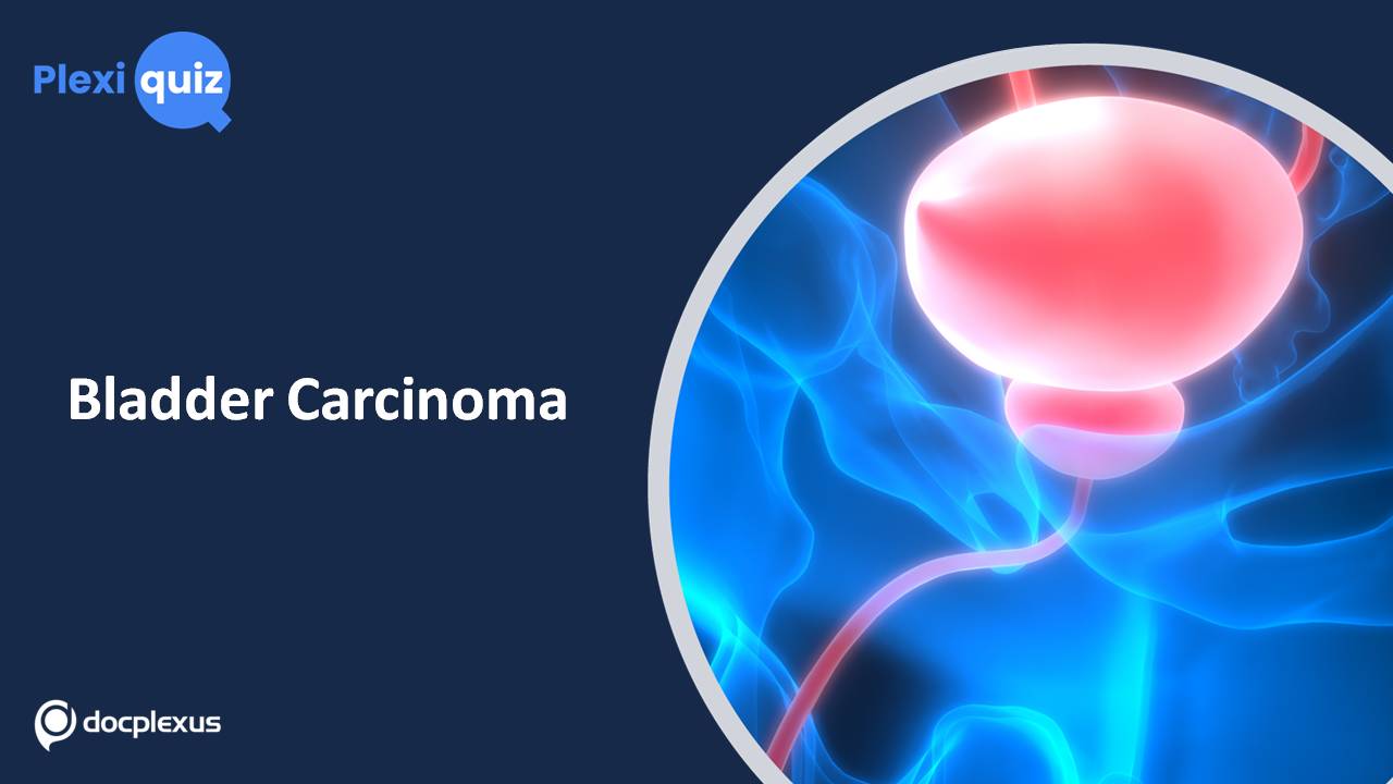 Refresh Your Knowledge on Bladder Cancer