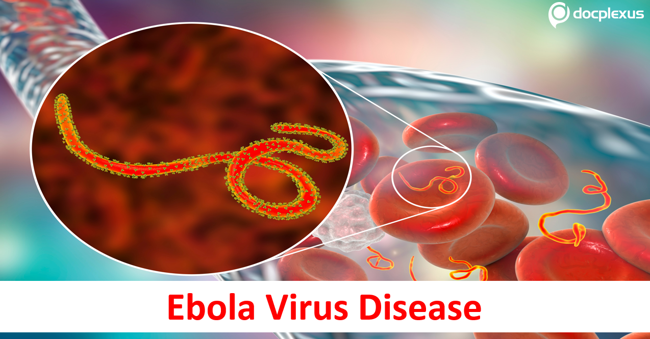Understanding the Ebola Virus