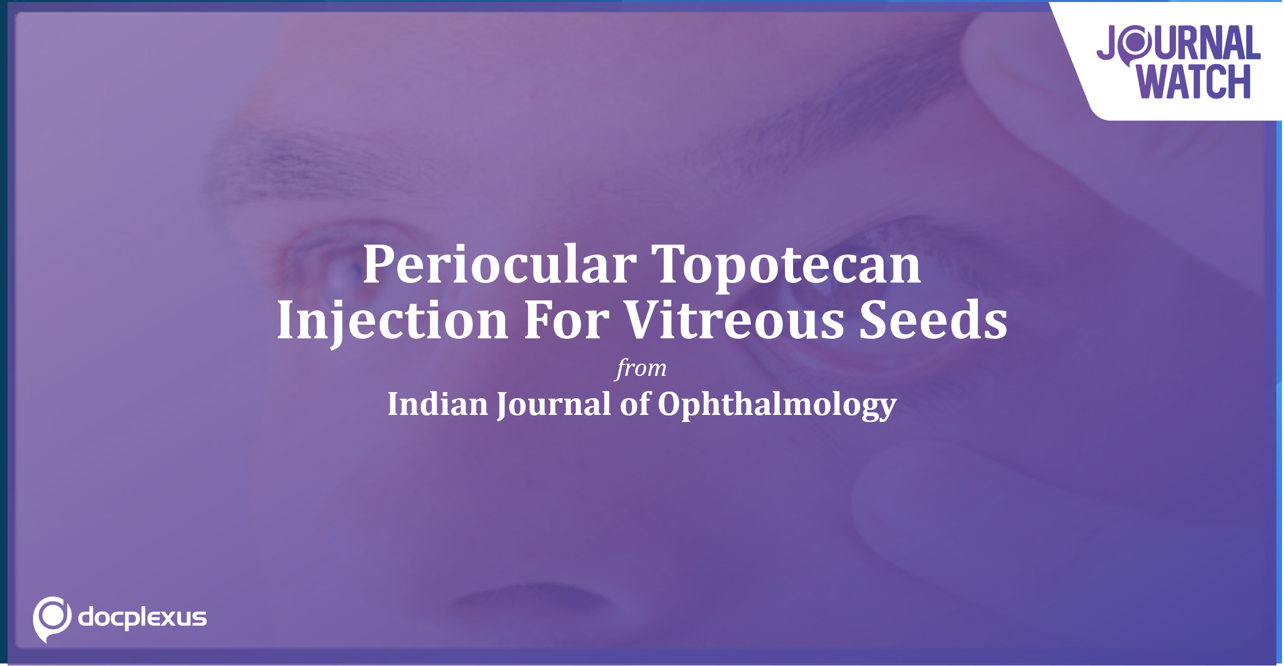 Periocular Topotecan In The Management Of Vitreous Seeds In Retinoblastoma