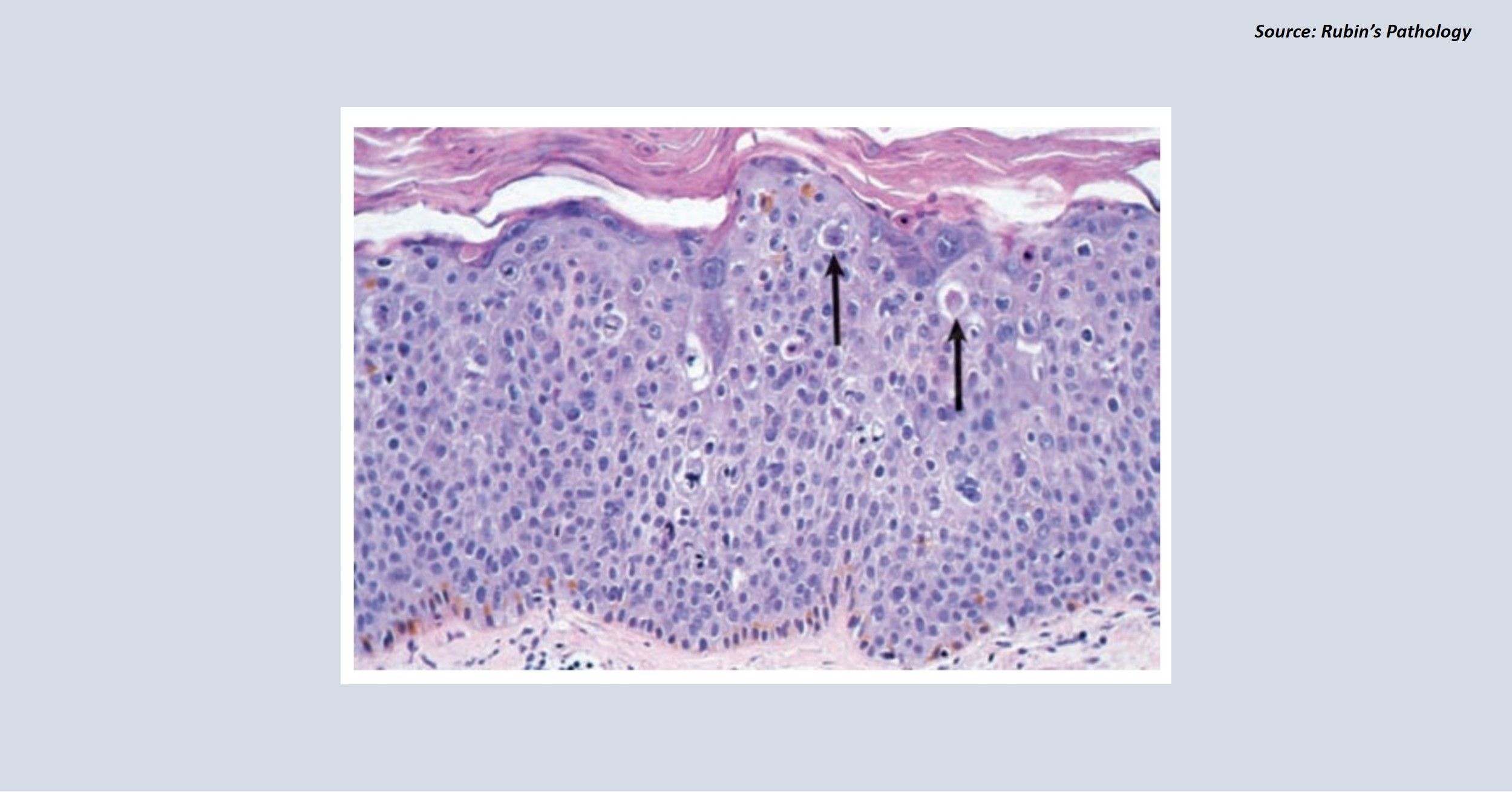 Role of Proteins in Programmed Cell Death