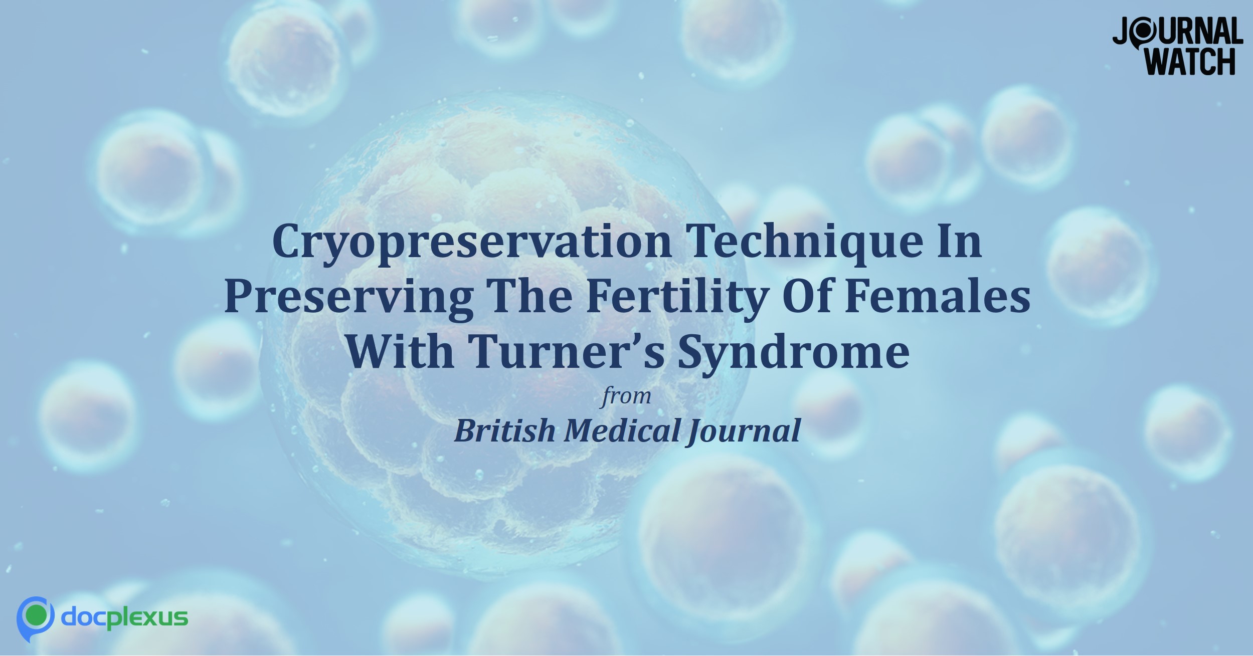 Cryopreservation Of The Ovarian Cortex Tissue In Girls Suffering From Turner’s Syndrome