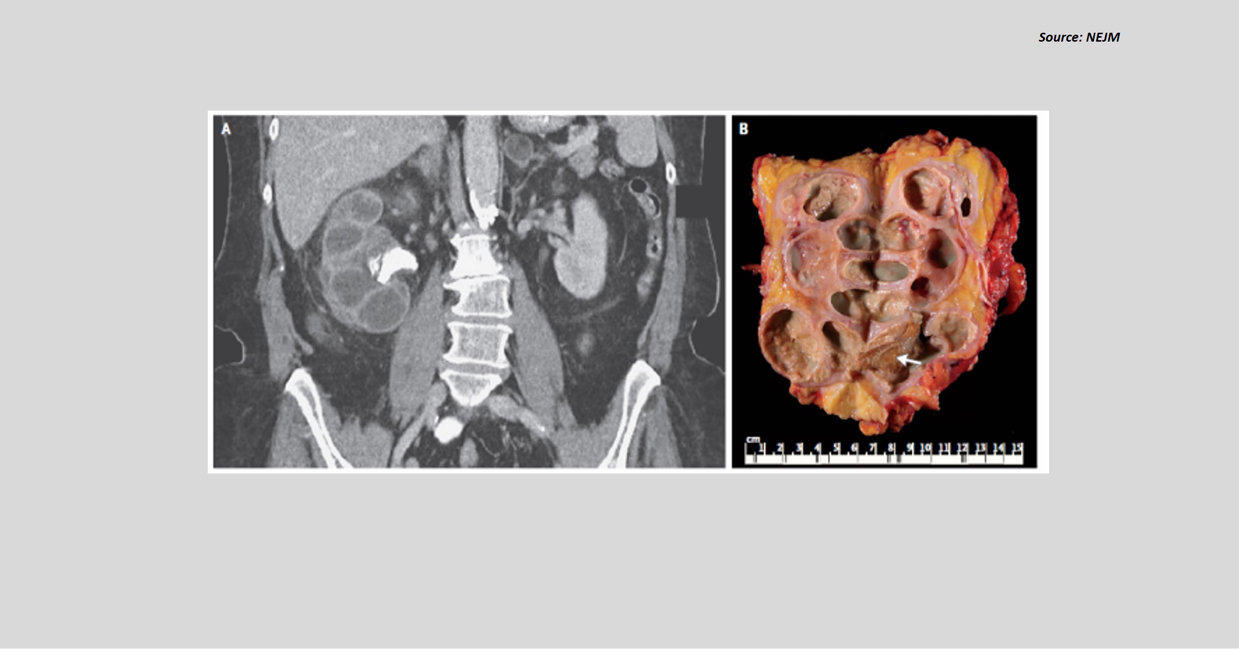 Can You Diagnose the Condition Based on the Image?