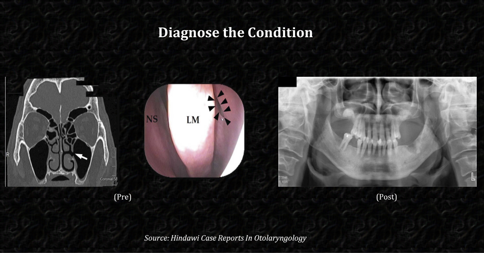What is the Confirmed Diagnosis in This Case?