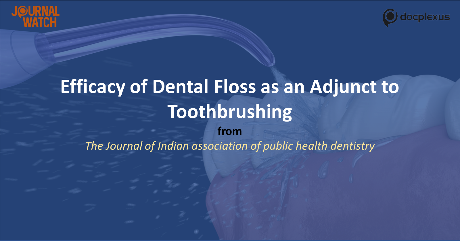Dental Floss as an Adjunct to Toothbrushing in Preventing Dental Plaque and Gingivitis