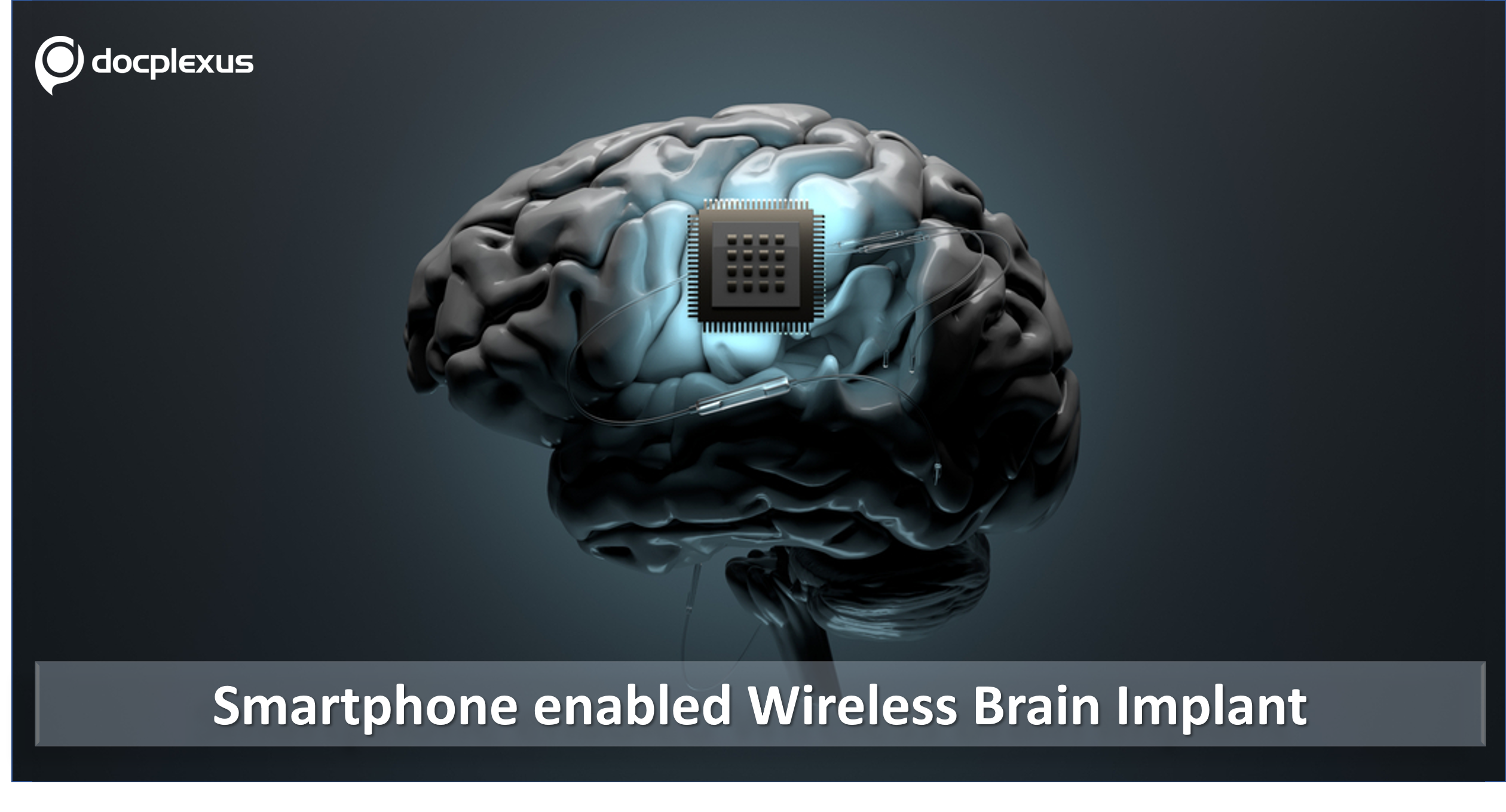 Smartphone- controlled Wireless, Soft Brain Implants