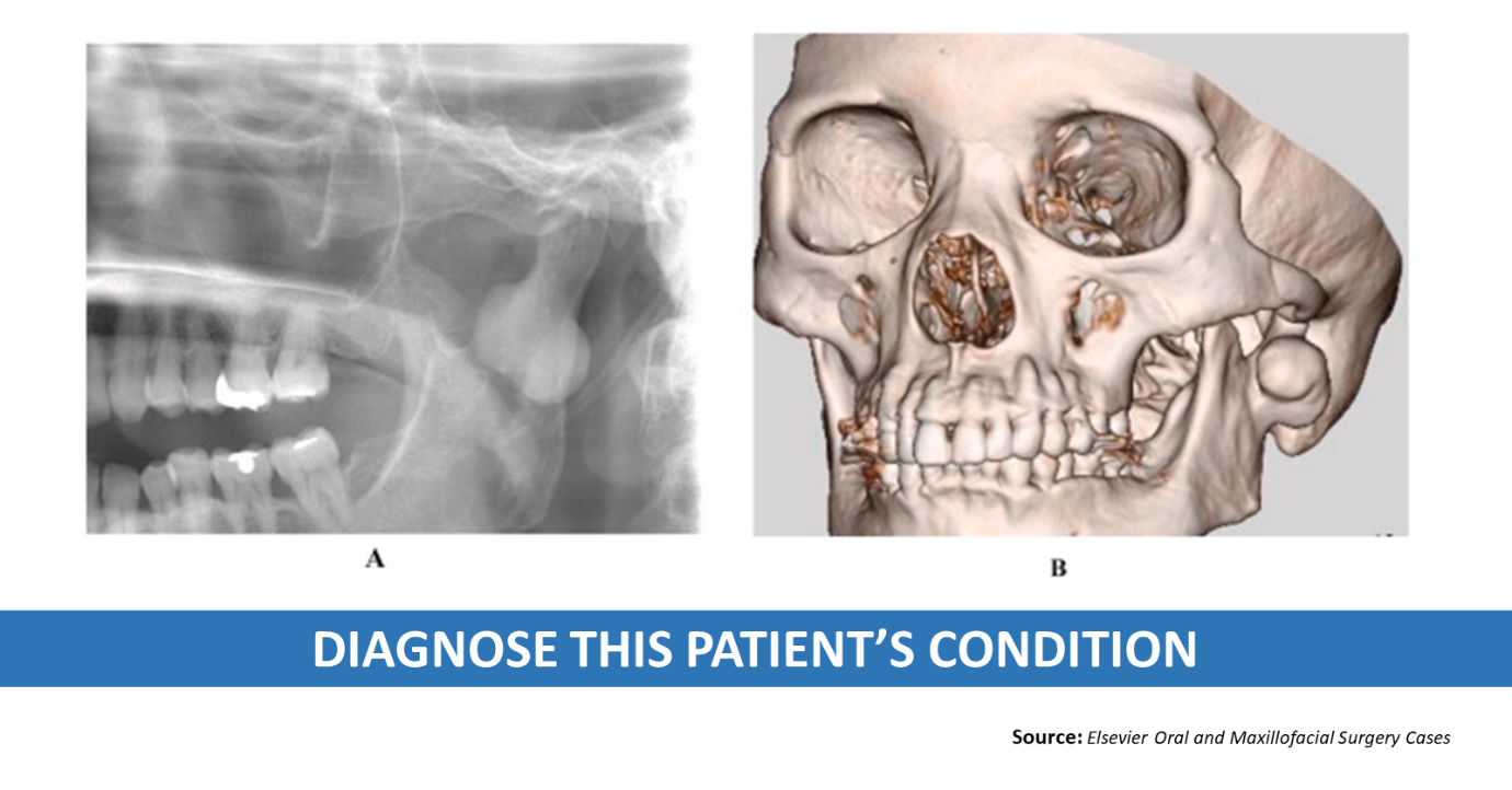 Diagnose This Patient's Condition